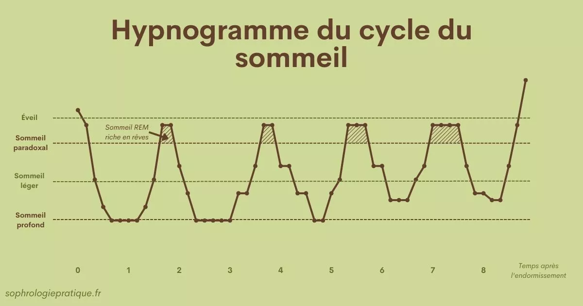 Schéma hypnogramme des cycles du sommeil