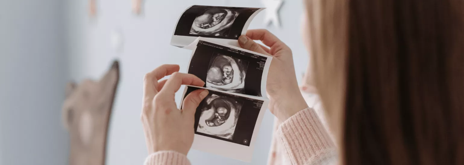 La sophrologie pour les femmes enceintes pendant la grossesse